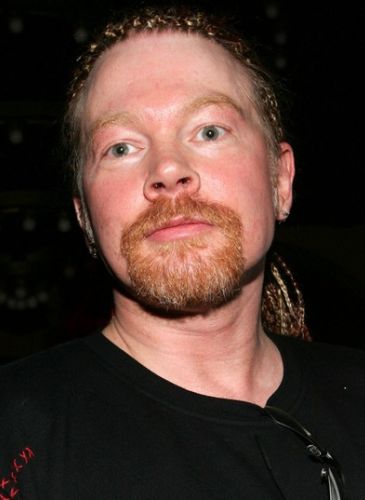 Axl Rose After Cosmetic Surgery