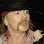 Axl Rose After Facelift