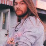 Axl Rose Before Cosmetic Procedure