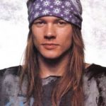 Axl Rose Before Cosmetic Surgery