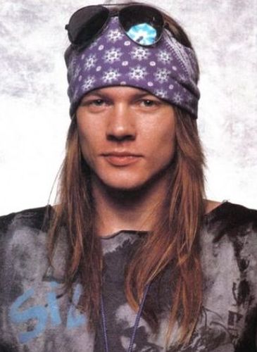 Axl Rose Before Cosmetic Surgery