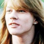 Axl Rose Before Plastic Surgery