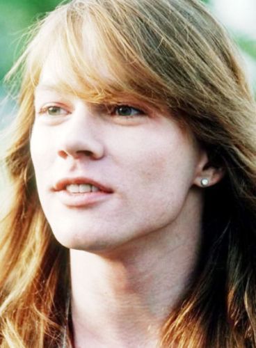 Axl Rose Before Plastic Surgery