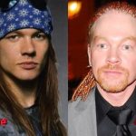 Axl Rose Before and After Facelift