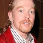 Axl Rose Plastic Surgery Controversy