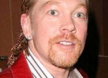 Axl Rose Plastic Surgery: A Bad Decision