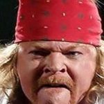 Axl Rose Plastic Surgery Transformation