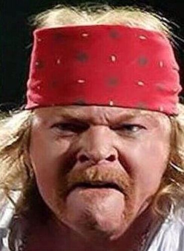Axl Rose Plastic Surgery Transformation