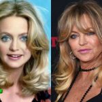 Goldie Hawn Before and After Cosmetic Surgery 150x150