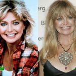Goldie Hawn Plastic Surgery Before and After 150x150