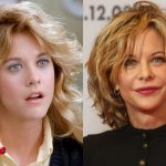 Meg Ryan Before and After Cosmetic Surgery