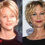 Meg Ryan Plastic Surgery Before and After