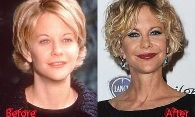 Meg Ryan’s Dramatic Transformation: The Untold Story Behind Her Plastic Surgery Rumors