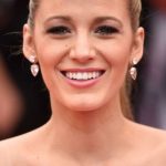 Blake Lively After Cosmetic Surgery 150x150