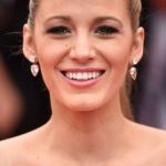 Blake Lively After Cosmetic Surgery 150x150 Blake Lively After Cosmetic Surgery 150x150