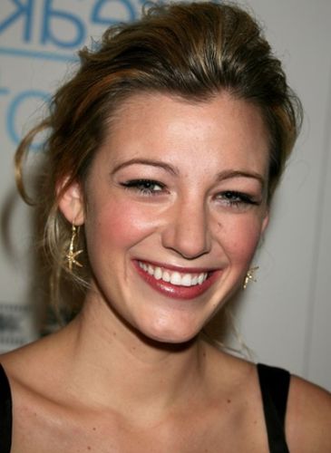 Blake Lively Before Cosmetic Surgery