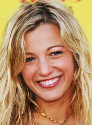 Blake Lively Before Plastic Surgery