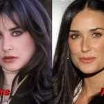 Demi Moore Plastic Surgery Before and After 150x150