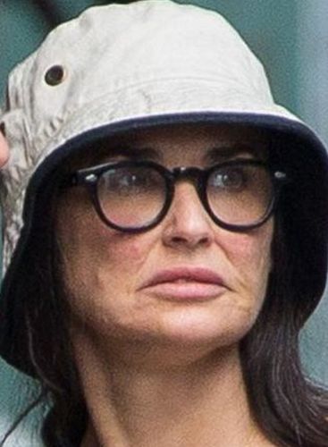 Demi Moore Plastic Surgery Fail