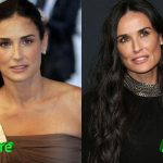 Demi Moore Surgery Transformation Before and After 150x150
