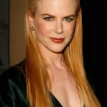 Nicole Kidman After Cosmetic Surgery 150x150