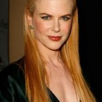 Nicole Kidman After Cosmetic Surgery 150x150