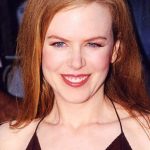 Nicole Kidman Before Cosmetic Surgery 150x150