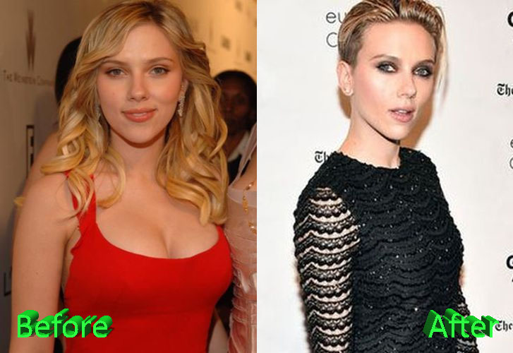 Scarlett Johansson Before and After Boob Job.