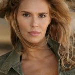 Brandi Glanville Before Botox Procedure 150x150