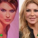 Brandi Glanville Before and After Cosmetic Surgery 150x150