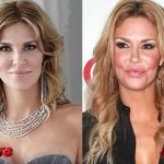 Brandi Glanville Plastic Surgery Before and After 150x150