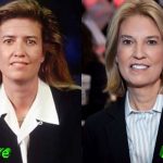 Greta Van Susteren Before and After Surgery Transformation 150x150