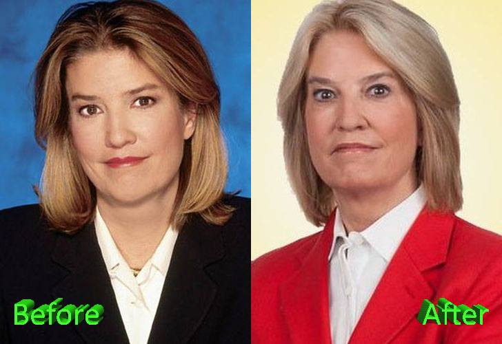 Greta Van Susteren Plastic Surgery Before and After