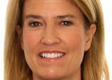 Greta Van Susteren Plastic Surgery: Off The Record