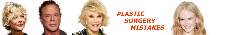 PlasticSurgeryMistakes