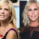 Vicki Gunvalson Before and After Surgery Transformation 150x150