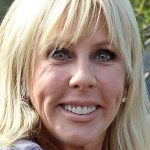 Vicki Gunvalson Facelift Procedure 150x150