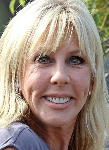 Vicki Gunvalson Facelift Procedure