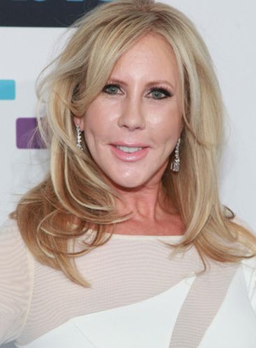 Vicki Gunvalson Plastic Surgery Gossips