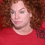 Carrot Top After Cosmetic Surgery 150x150