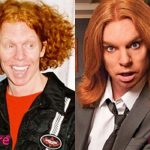 Carrot Top Before and After Surgery Transformation 150x150