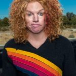 Carrot Top Cosmetic Surgery Procedure 150x150