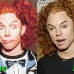 Carrot Top Plastic Surgery Before and After 150x150