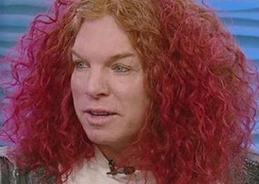 Carrot Top Plastic Surgery: Not So Funny Anymore