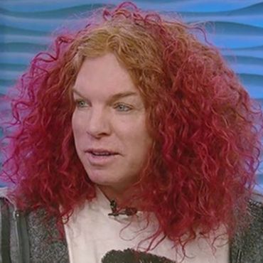 Carrot Top Plastic Surgery: Not So Funny Anymore