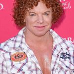 Carrot Top Plastic Surgery Gossips 150x150