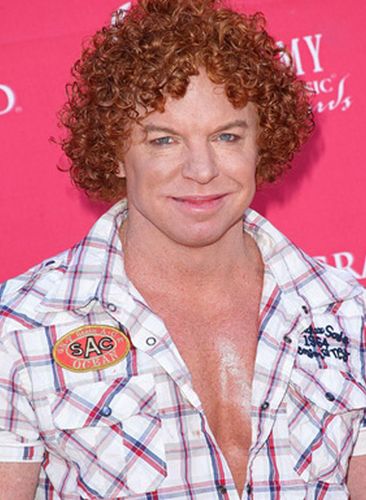 Carrot Top Plastic Surgery Gossips