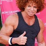 Carrot Top Plastic Surgery Mistake 150x150