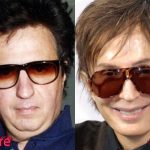 Michael Cimino Before and After Cosmetic Surgery 150x150