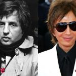 Michael Cimino Plastic Surgery Before and After 150x150